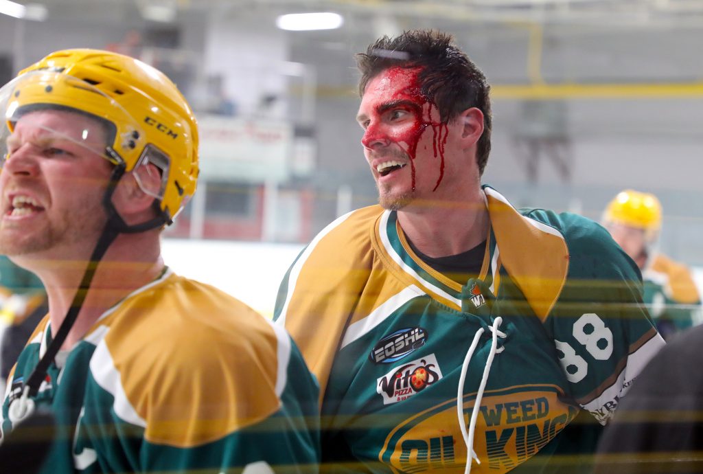 A photo of two players, one with blood on his head.