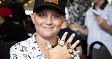 A boy shows off some rings.